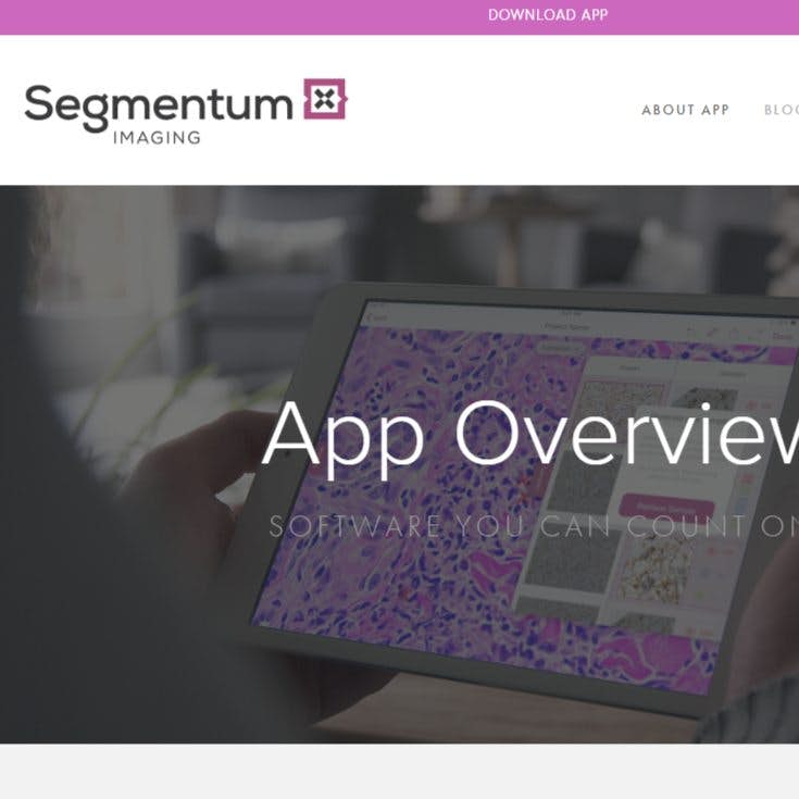 Segmentum Analysis