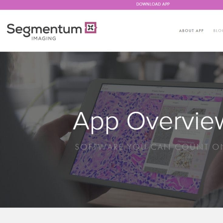Segmentum Analysis preview